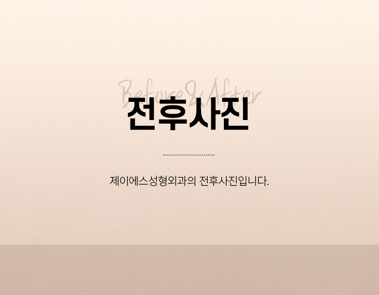 sub_top_bam.jpg